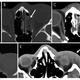 Illustration for article titled Researchers Study How X-Rays Can Be a Flag for Domestic Violence
